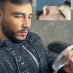 تصویر 4 کلینیک پوست مو زیبایی لیزر هیمو