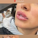 تصویر 1 کلینیک پوست مو زیبایی لیزر هیمو