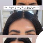 تصویر 2 کلینیک پوست مو زیبایی لیزر هیمو