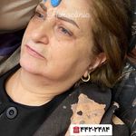 تصویر 3 کلینیک پوست مو زیبایی لیزر هیمو