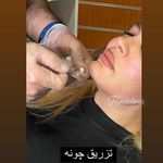 تصویر 3 کلینیک پوست مو زیبایی لیزر هیمو