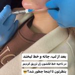 تصویر 1 کلینیک پوست مو زیبایی لیزر هیمو