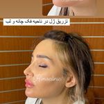 تصویر 3 کلینیک پوست مو زیبایی لیزر هیمو