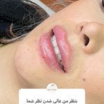 تصویر 4 کلینیک پوست مو زیبایی لیزر هیمو