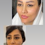 تصویر 2 کلینیک پوست مو زیبایی لیزر هیمو