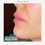 تصویر 1 کلینیک پوست مو زیبایی لیزر هیمو