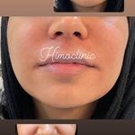 تصویر 3 کلینیک پوست مو زیبایی لیزر هیمو
