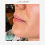تصویر 4 کلینیک پوست مو زیبایی لیزر هیمو