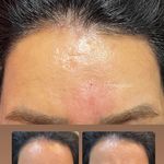 تصویر 0 کلینیک پوست مو زیبایی لیزر هیمو