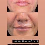 تصویر 0 کلینیک پوست مو زیبایی لیزر هیمو