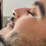 تصویر 3 کلینیک پوست مو زیبایی لیزر هیمو