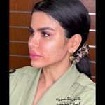 تصویر 4 کلینیک پوست مو زیبایی لیزر هیمو