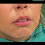 تصویر 2 کلینیک پوست مو زیبایی لیزر هیمو