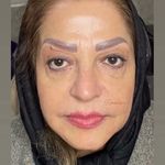 تصویر 2 کلینیک پوست مو زیبایی لیزر هیمو