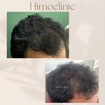 تصویر 4 کلینیک پوست مو زیبایی لیزر هیمو