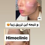 تصویر 4 کلینیک پوست مو زیبایی لیزر هیمو
