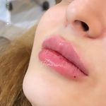 تصویر 4 کلینیک پوست مو زیبایی لیزر هیمو