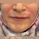 تصویر 1 کلینیک پوست مو زیبایی لیزر هیمو