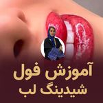 تصویر 0 فیبروز مریم میرقاسمی