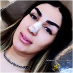 تصویر 1 کاشت مژه بانوان سمیه خوش اخلاق