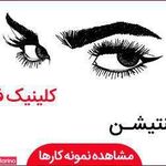 تصویر 2 سالن میکرو آرزو