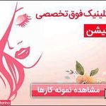 تصویر 0 سالن میکرو آرزو