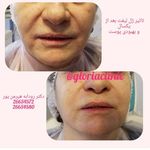 تصویر 4 کیلینیک پوست مو زیبایی گلوریا