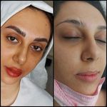 تصویر 0 سالن تخصصی ابرو پریاقدس