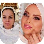 تصویر 1 آرایشگاه لورا