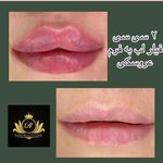 تصویر 3 کلینیک زیبایی ریجینا