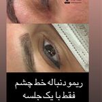 تصویر 3 آکادمی ریموو تاتو سپیده رجب زاده