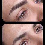 تصویر 2 مرکز خدمات و آموزش میکروبلیدینگ ، میکروپیگمنتیشن و ریموو