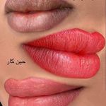 تصویر 1 مرکز خدمات و آموزش میکروبلیدینگ ، میکروپیگمنتیشن و ریموو