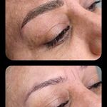 تصویر 4 مرکز خدمات و آموزش میکروبلیدینگ ، میکروپیگمنتیشن و ریموو