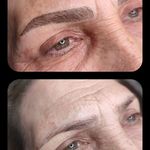 تصویر 1 مرکز خدمات و آموزش میکروبلیدینگ ، میکروپیگمنتیشن و ریموو