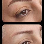 تصویر 0 مرکز خدمات و آموزش میکروبلیدینگ ، میکروپیگمنتیشن و ریموو