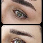 تصویر 4 مرکز خدمات و آموزش میکروبلیدینگ ، میکروپیگمنتیشن و ریموو