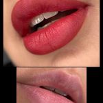 تصویر 0 مرکز خدمات و آموزش میکروبلیدینگ ، میکروپیگمنتیشن و ریموو