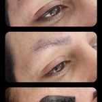 تصویر 2 مرکز خدمات و آموزش میکروبلیدینگ ، میکروپیگمنتیشن و ریموو