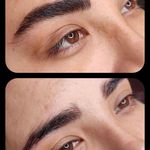 تصویر 1 مرکز خدمات و آموزش میکروبلیدینگ ، میکروپیگمنتیشن و ریموو