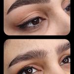 تصویر 4 مرکز خدمات و آموزش میکروبلیدینگ ، میکروپیگمنتیشن و ریموو