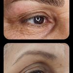 تصویر 4 مرکز خدمات و آموزش میکروبلیدینگ ، میکروپیگمنتیشن و ریموو