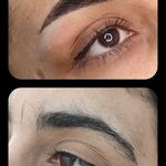 تصویر 3 مرکز خدمات و آموزش میکروبلیدینگ ، میکروپیگمنتیشن و ریموو