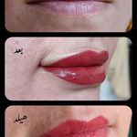 تصویر 0 مرکز خدمات و آموزش میکروبلیدینگ ، میکروپیگمنتیشن و ریموو