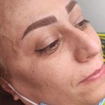 تصویر 2 مرکز خدمات و آموزش میکروبلیدینگ ، میکروپیگمنتیشن و ریموو