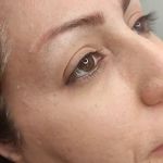 تصویر 0 مرکز خدمات و آموزش میکروبلیدینگ ، میکروپیگمنتیشن و ریموو