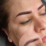 تصویر 0 مرکز خدمات و آموزش میکروبلیدینگ ، میکروپیگمنتیشن و ریموو