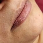 تصویر 4 مرکز خدمات و آموزش میکروبلیدینگ ، میکروپیگمنتیشن و ریموو