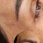 تصویر 1 مرکز خدمات و آموزش میکروبلیدینگ ، میکروپیگمنتیشن و ریموو