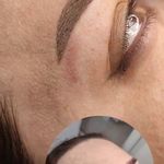 تصویر 0 مرکز خدمات و آموزش میکروبلیدینگ ، میکروپیگمنتیشن و ریموو